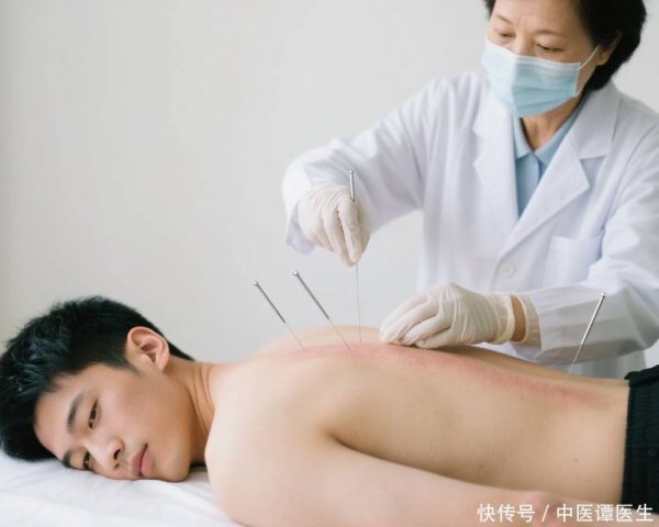 顺市配资 针灸后总犯困、出汗，是正常反应还是异常信号？医生这样解释